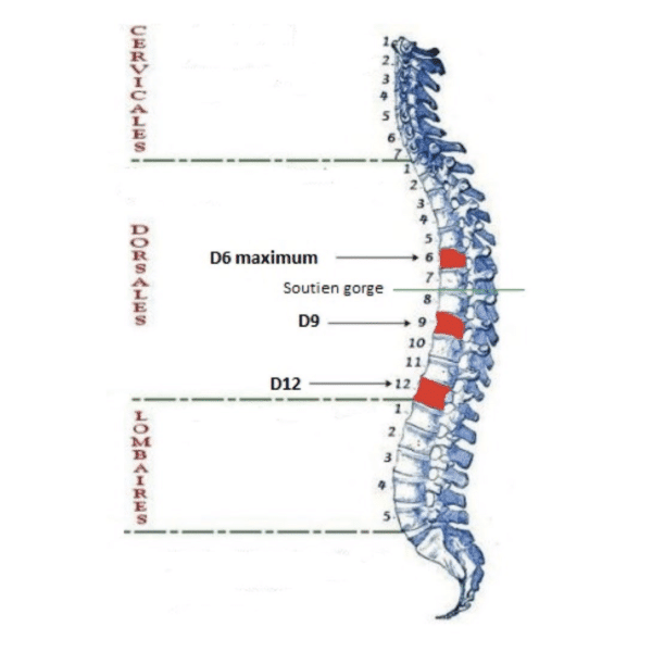 Corset Thermoformé Petit appareillage. Fractures des vertèbres, hernies discales, tassements vertébraux, ostéoporose en zone dorsale D6, D9, D12. Rendez-vous au magasin, nécessaire pour réaliser l’appareillage.